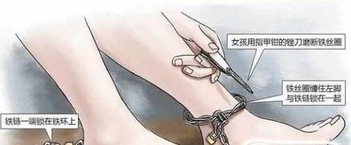 \