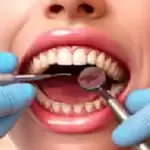 清洁牙齿狂热CleanTeethCraze