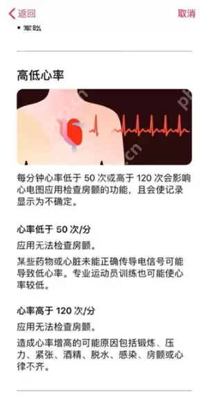 Apple Watch心电图有哪些检测结果