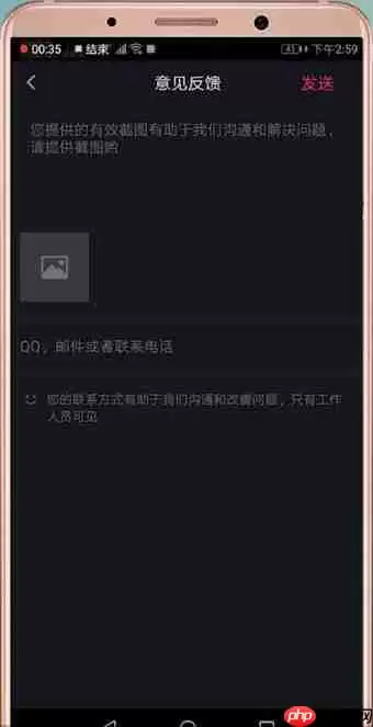 在抖音里怎么联系客服?联系客服的方法说明