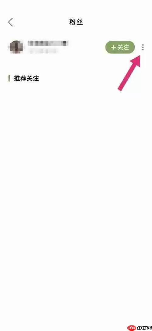 绿洲粉丝怎么移除