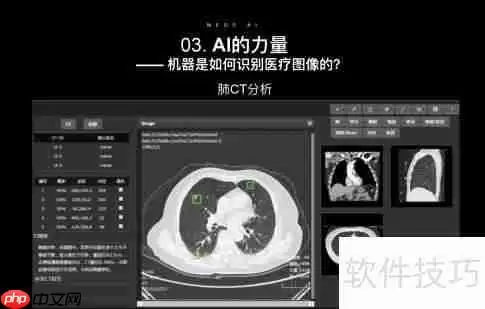 智能医疗影像系统方案开发：推动医疗行业新变革