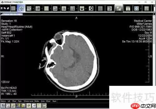 LEADTOOLS医学影像工作站使用教程