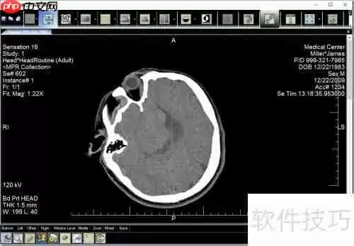 LEADTOOLS医学影像工作站使用入门指南