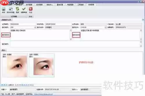 美容院管理软件如何记录会员服务前后效果？