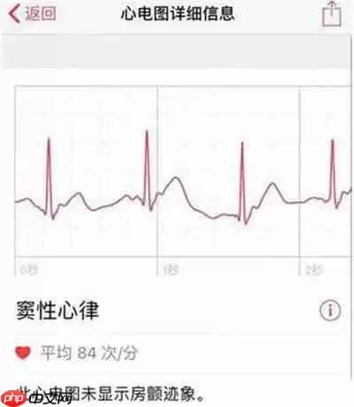 Apple Watch怎么查看心电图
