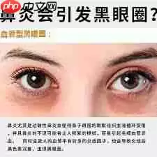 黑眼圈是因为睡眠不足吗
