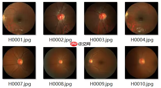 ResNet及BCD版本详解且在眼疾识别中应用实例 - 游乐网