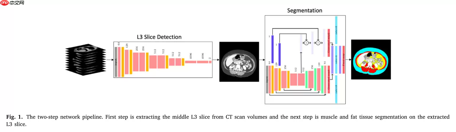 『医学影像』基于Unet+++实现脊柱MRI定位（上） - 游乐网