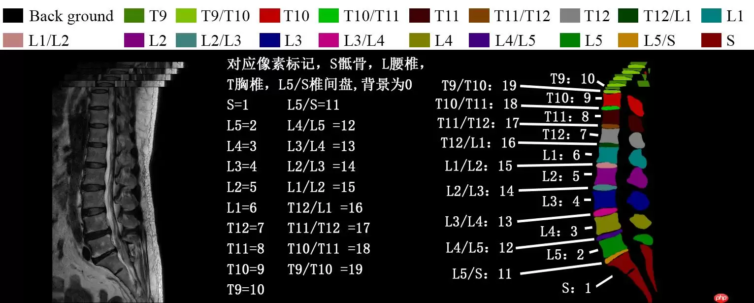 『医学影像』基于Unet+++实现脊柱MRI定位（上） - 游乐网