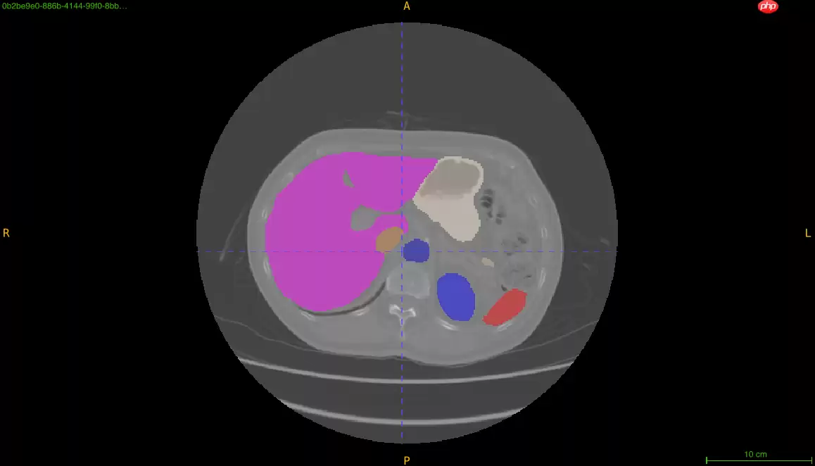 “中国软件杯”大学生软件设计大赛-3D智慧医疗baseline - 游乐网