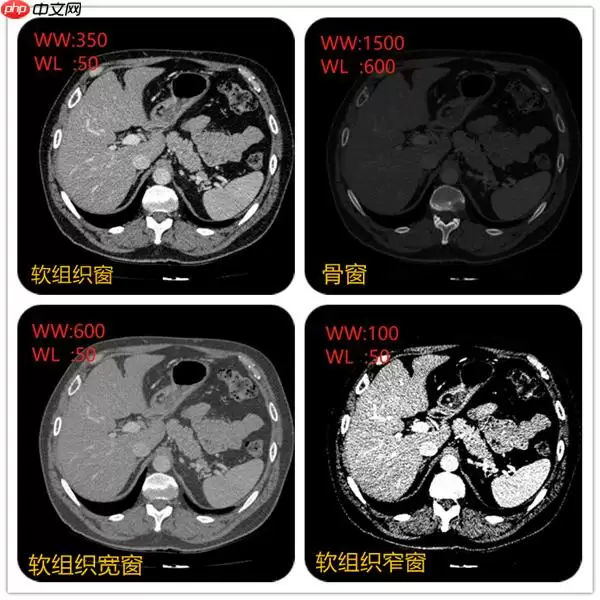 CT影像数据DICOM与图像分割(paddle2.0) - 游乐网