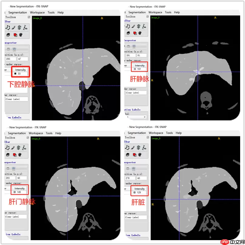 CT影像数据DICOM与图像分割(paddle2.0) - 游乐网