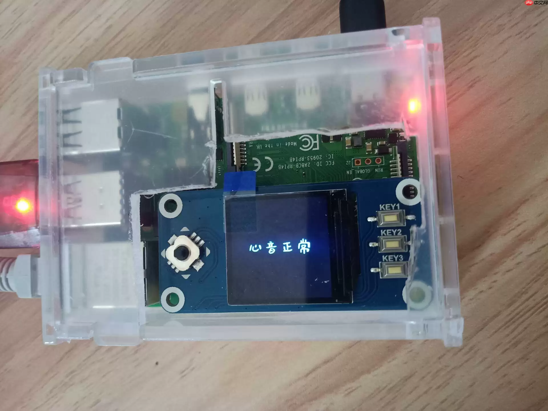 心音智能检测 - 游乐网