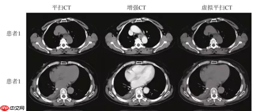 基于分割网络Unet生成虚拟图像 - 游乐网