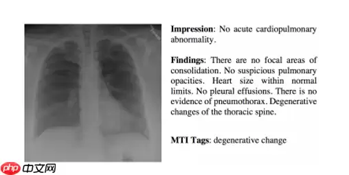 『IMAGE-CAPTION』基于CNN-RNN的影像报告生成-PRE - 游乐网