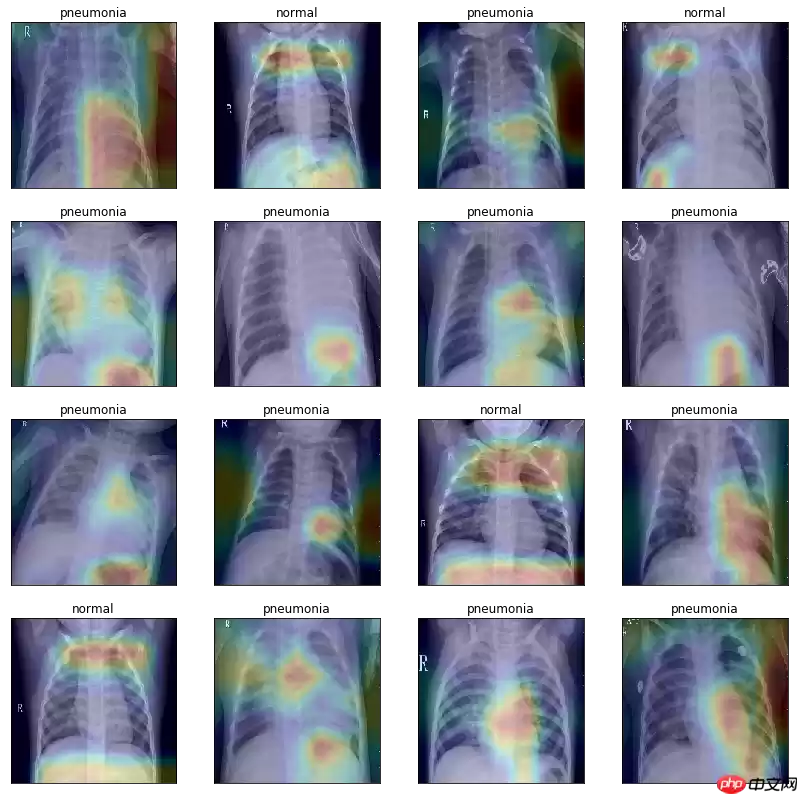 基于PaddlePaddle搭建儿童X光胸部肺炎分类项目 - 游乐网