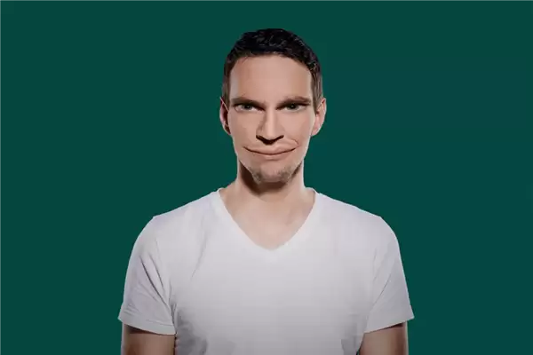 荷兰女子患罕见疾病 看到的人脸会扭曲为龙脸