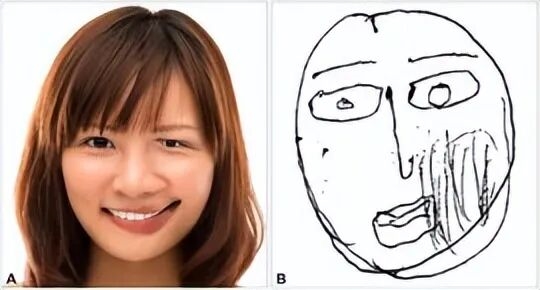 荷兰女子患罕见疾病 看到的人脸会扭曲为龙脸