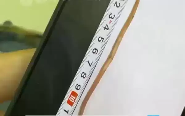 11岁男孩感染寄生虫瘦到15公斤：治疗排出一条13厘米长蛔虫