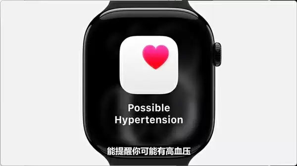 Apple Watch Series 11发布：新增高血压检测提醒 399美元