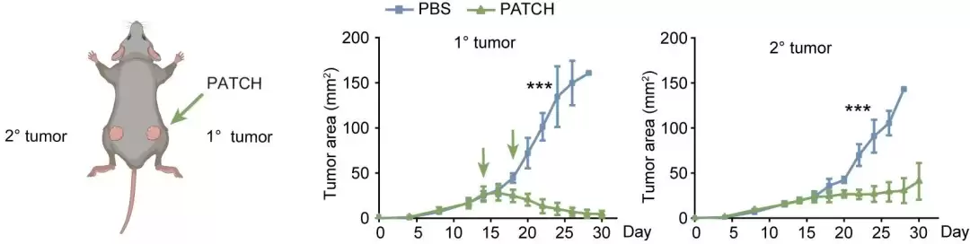 免疫治疗重要突破：我国科研人员开发出可精准识别癌细胞的“纳米标记机器人”