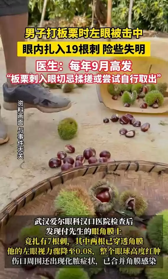 男子打板栗:左眼扎入19根刺险失明