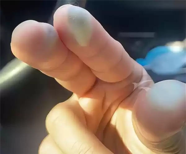 别名“化骨水”!女子散步时踩到氢氟酸后不幸去世