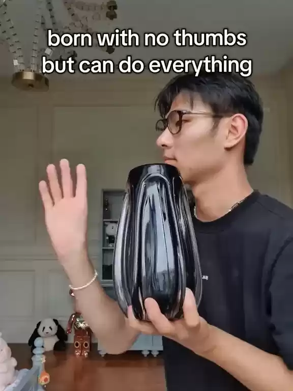 男子天生缺少拇指