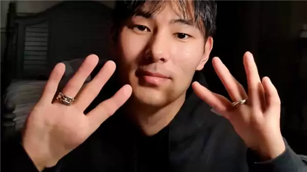 男子天生缺少拇指