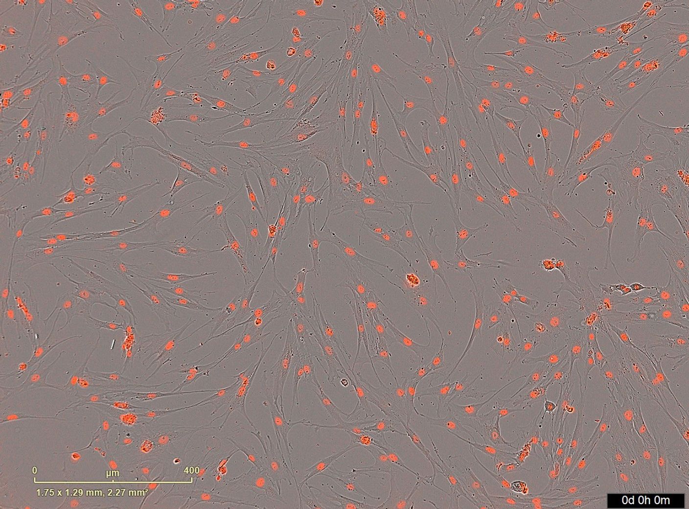 MSCs干细胞染色影像