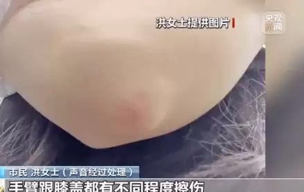 共享单车频现自动锁车事故 安全隐患与责任归属引争议