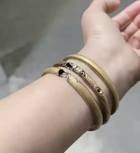 宿州女子充电时触电手部烧伤 金手镯碎裂疑因设备漏电