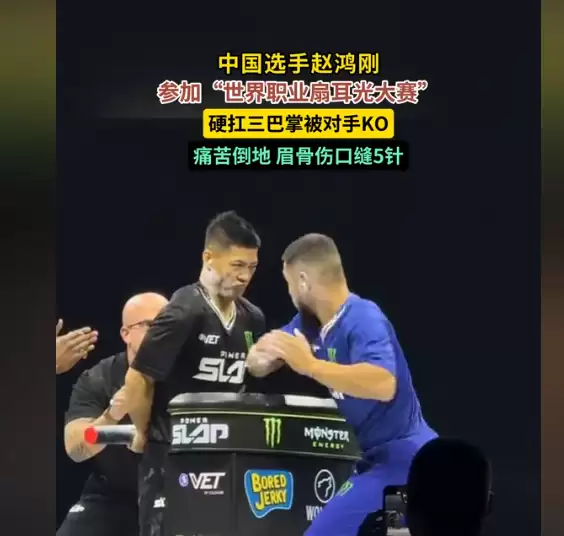 中国通背拳传人赵鸿刚参加世界职业扇耳光大赛遭KO:眉骨缝5针 本人回应:没有脑震荡
