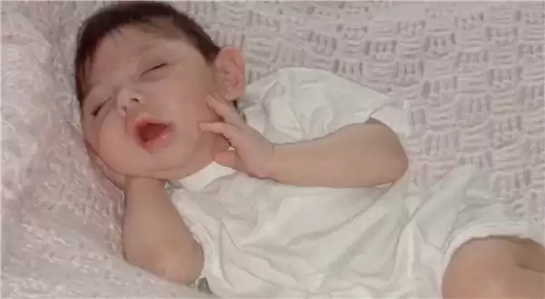 被医生断言活不过5岁 美国天生无脑女子创最长存活记录