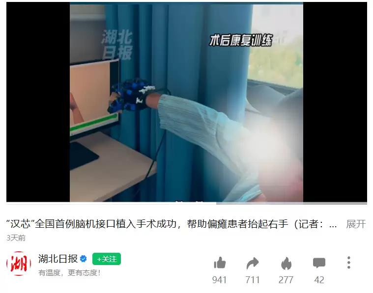 衮华脑机全国产自主研发脑机芯片首次临床植入成功，偏瘫患者重获“抓握之力” /></p><p>刘先生两年前因突发脑梗导致右侧肢体严重瘫痪，右手功能基本丧失，日常生活受到极大影响。虽然他一直坚持系统康复治疗，甚至尝试了无创脑机接口训练，但手部功能始终未见明显改善。</p><p>今年9月22日，协和医院神经外科主任姜晓兵教授领衔的医疗团队，成功为刘先生实施了全国产自主研发脑机接口芯片的首次临床植入手术。</p><p>术后，系统通过衮华脑机自主研发的智能解码算法，将患者“意念”驱动手指伸展或抓握的神经信号，实时转化为气动手套的精准动作。这种