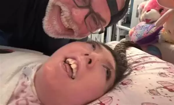 大脑缺失 小脑只有蚕豆大小!美国“无脑畸形”女子创造奇迹