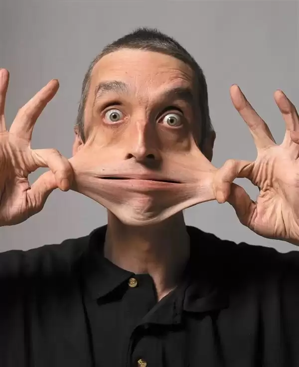 世界上皮肤最有“弹性”的男子 看完可能整个人都不好了