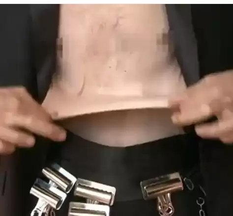 世界上皮肤最有“弹性”的男子 看完可能整个人都不好了