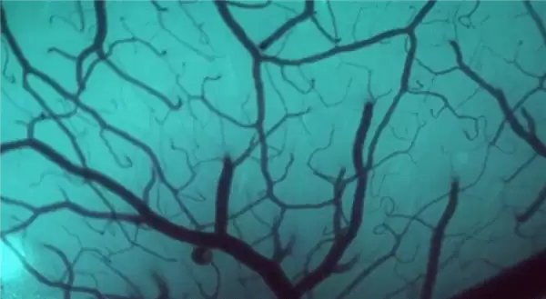 1.5秒植入!马斯克脑机接口公司技术新突破 超万人等待上脑