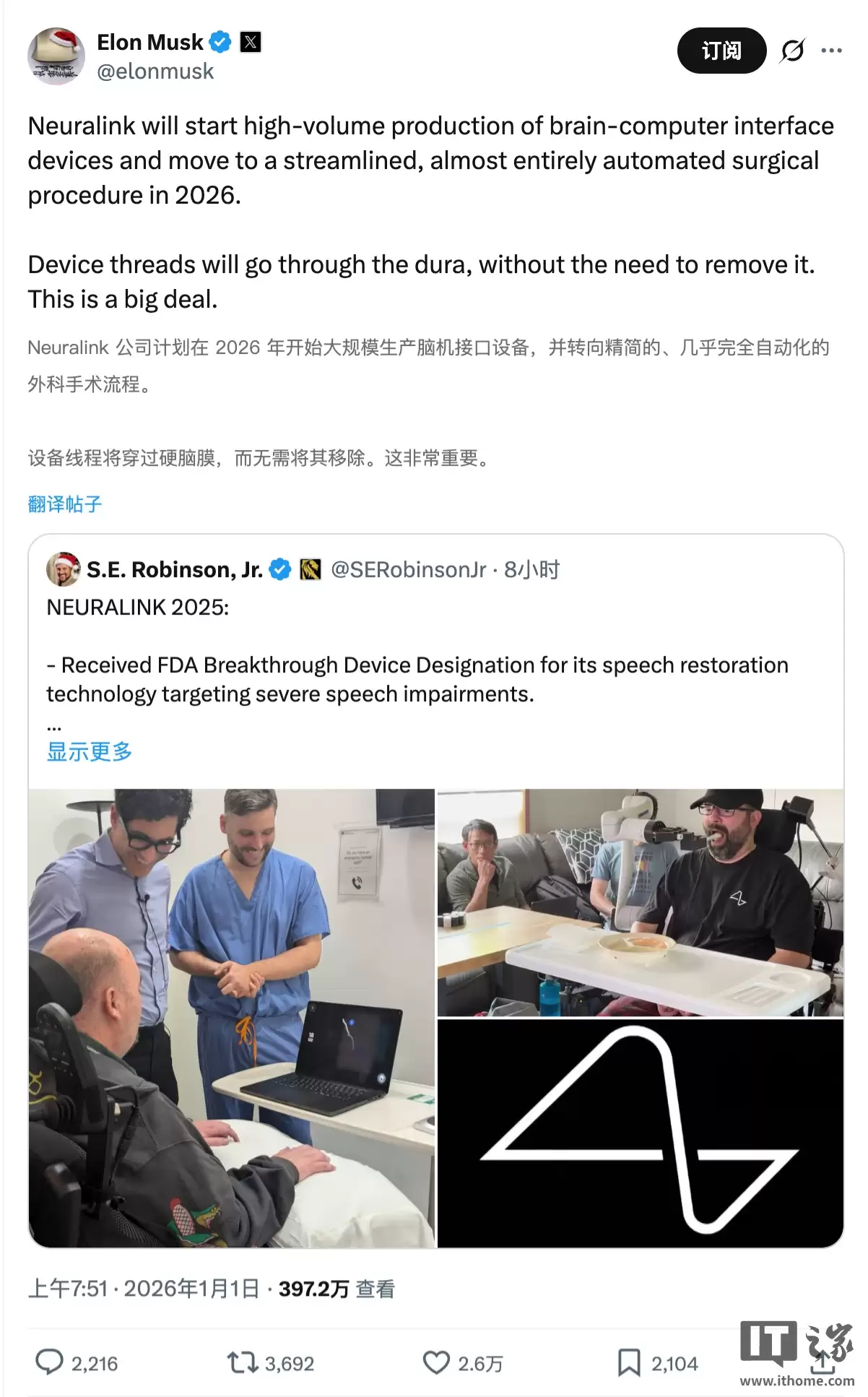 马斯克:2026 年将“大规模生产”脑机接口设备