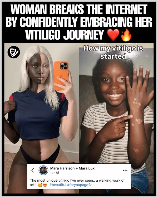 一个患有白化病的美国女孩火了 网友:还真能这么均匀