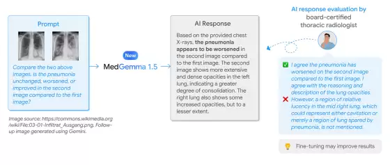谷歌发布医疗 AI 模型 MedGemma 1.5 4B:可本地部署,CT、MRI 都能处理