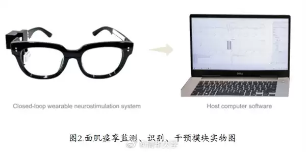 清华研发智能眼镜实现面肌痉挛无创治疗