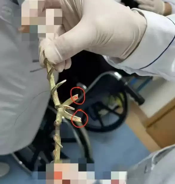 澳大利亚女子驾车遭追尾 头上鲨鱼发夹断裂致脑震荡