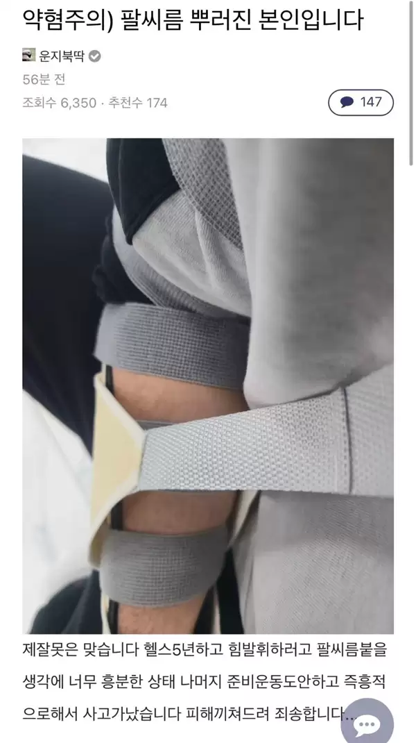 韩国玩家挑战《鸣潮》吉祥物椿：比赛掰手腕没曾想直接骨折！