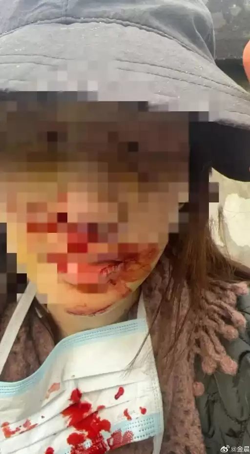 知名女星金晨被曝肇事逃逸 官方通报：细节公布