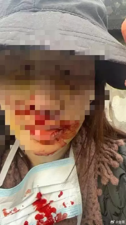 金晨车祸事件始末!一分钟带你吃明白这个瓜