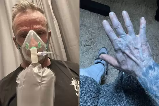 英国男子全身变蓝送去急救!医生一擦:床单掉色