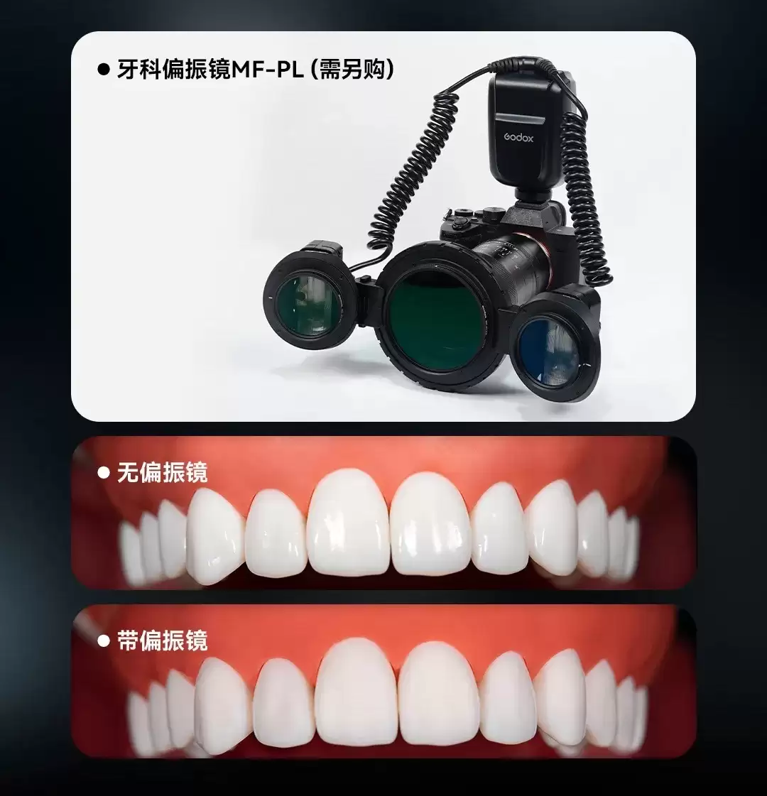 神牛MF-T76微距双头闪光灯开售：TTL自动闪光、1.2s高速回电，1299元